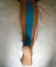 Kinesio taping illustrated